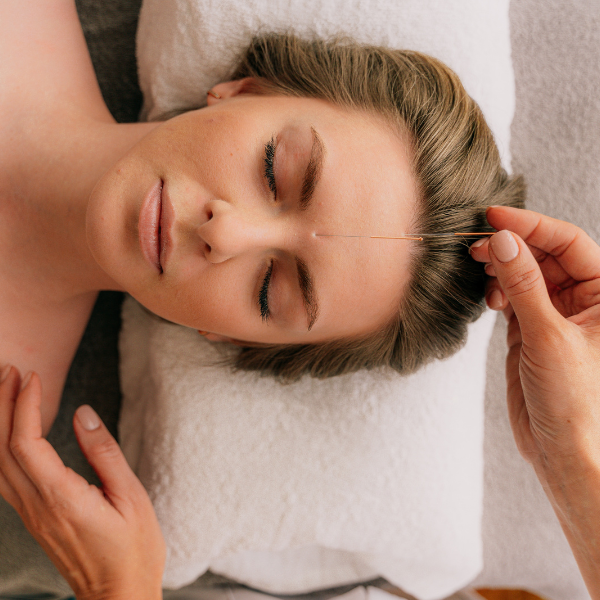 cosmetic acupuncture