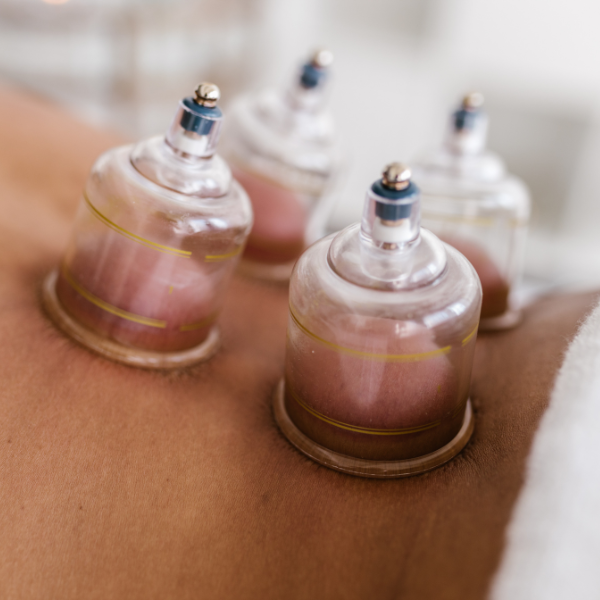 cupping