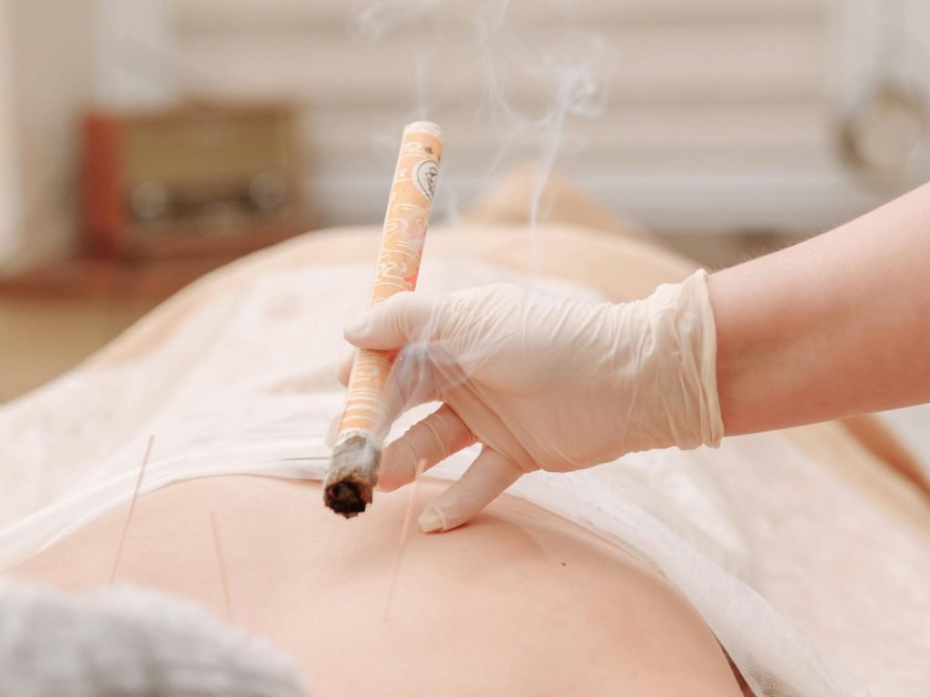 How Acupuncture Can Help Relieve Back Pain