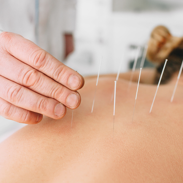 ancient acupuncture