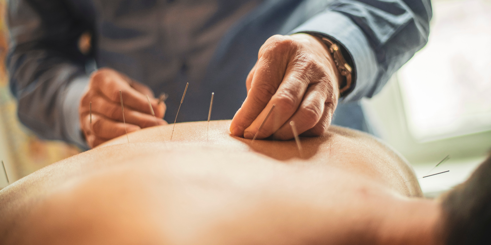 How Acupuncture Can Aid In Post-Surgery Recovery