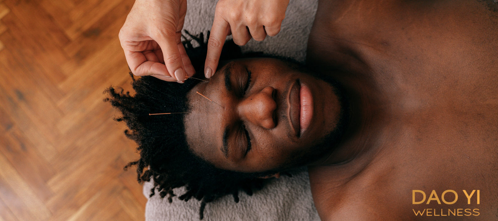How Acupuncture Can Aid In Chronic Pain Management For Veterans